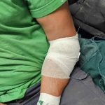 Barbat din Osesti retinut dupa ce a fost atacat cu pietre in plina zi la terasa